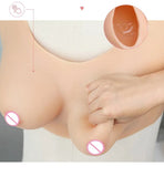 Formes silicone chirurgie esthétique